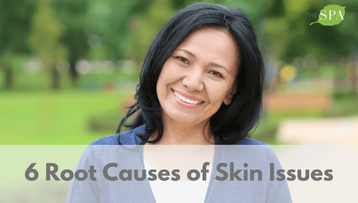 Senior Adult Woman Skin Issues