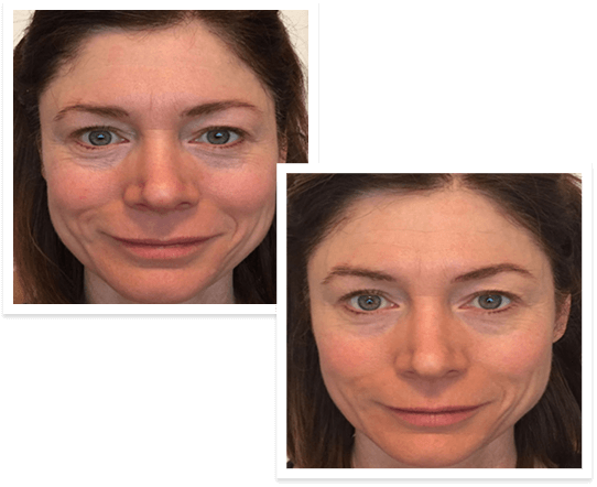 The Spa Dr Before and After results